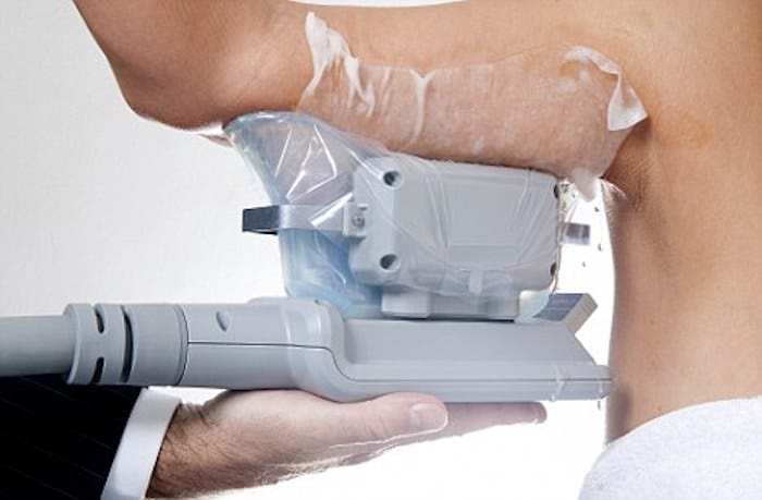 fat freezing arms Crawley