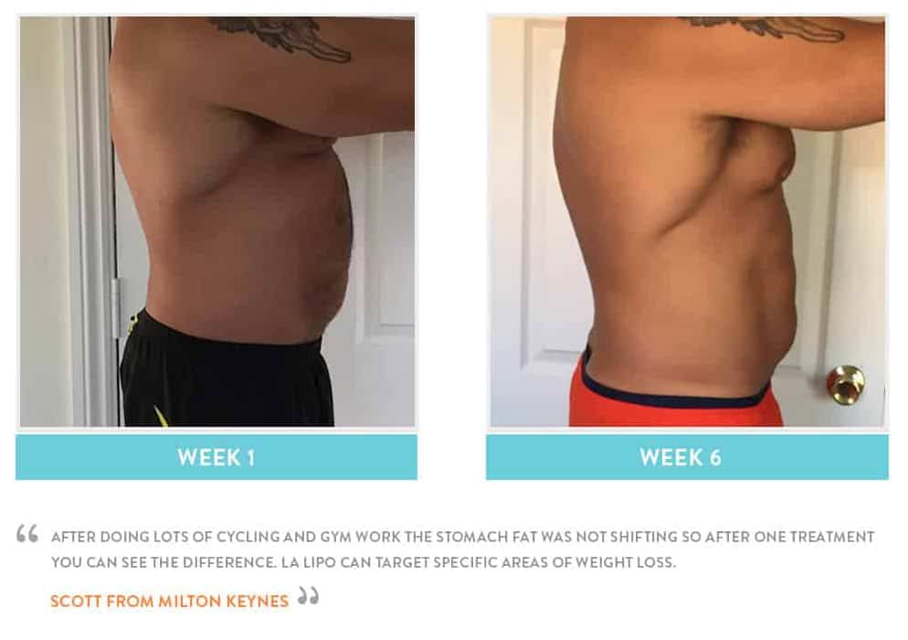 Before & After Stomach Fat Crawley