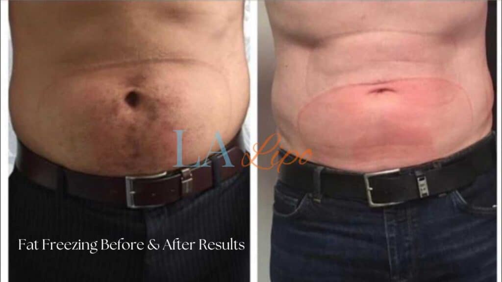 Before & After