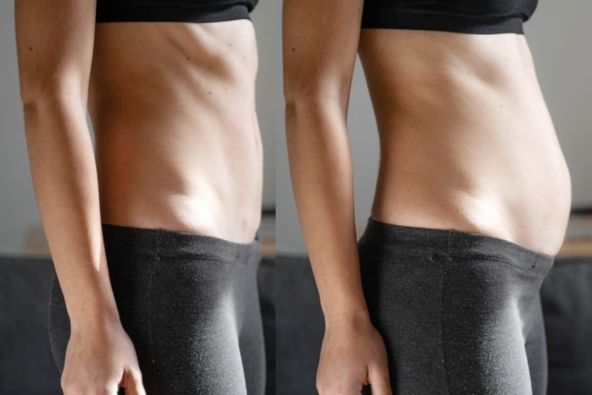 How long does diastasis recti take to improve Crawley?