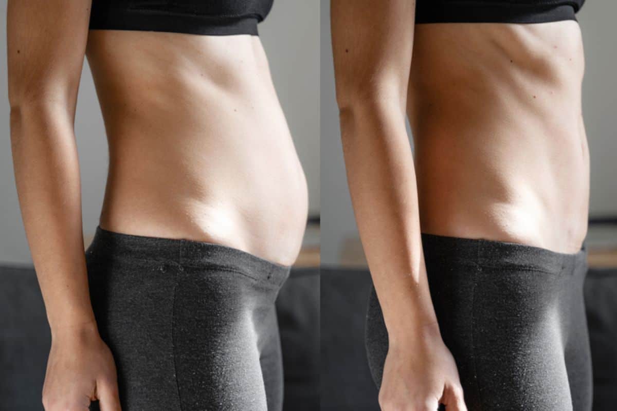 Post-Pregnancy: What Happens to Your Abdominal Muscles After Birth Crawley
