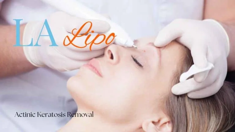 Woman receiving Actinic Keratosis Removal Treatment Crawley