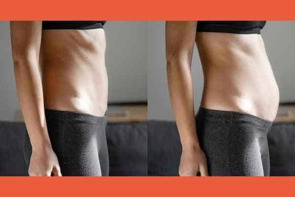 LA-EMS Body Sculpting results Crawley