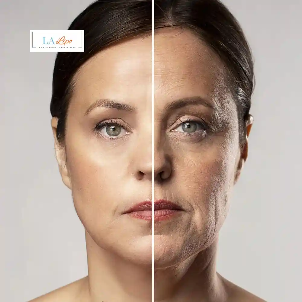 How Can You Tell If Non-Surgical Skin Tightening Is Right for You Crawley?