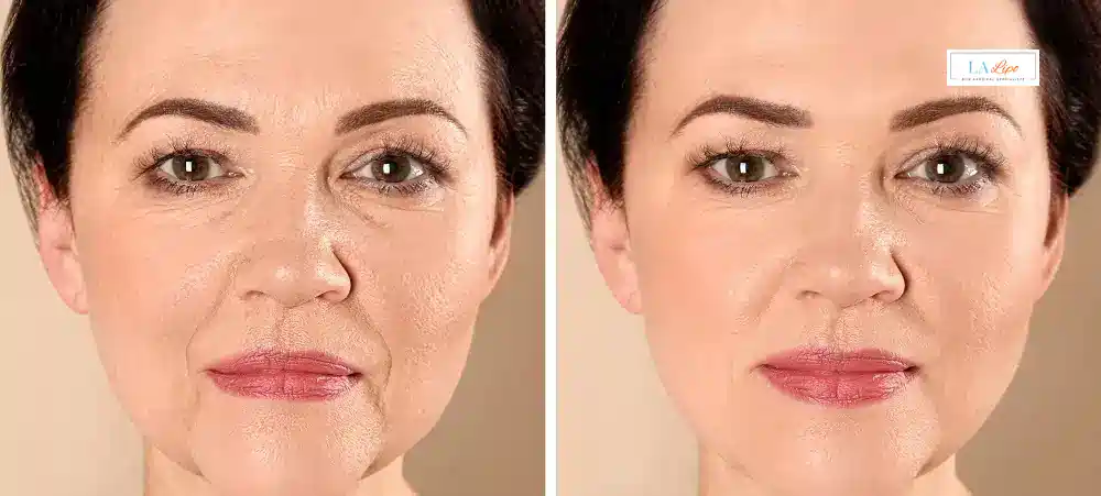 How Long Does It Take to See Results and How Long Do They Last Crawley?