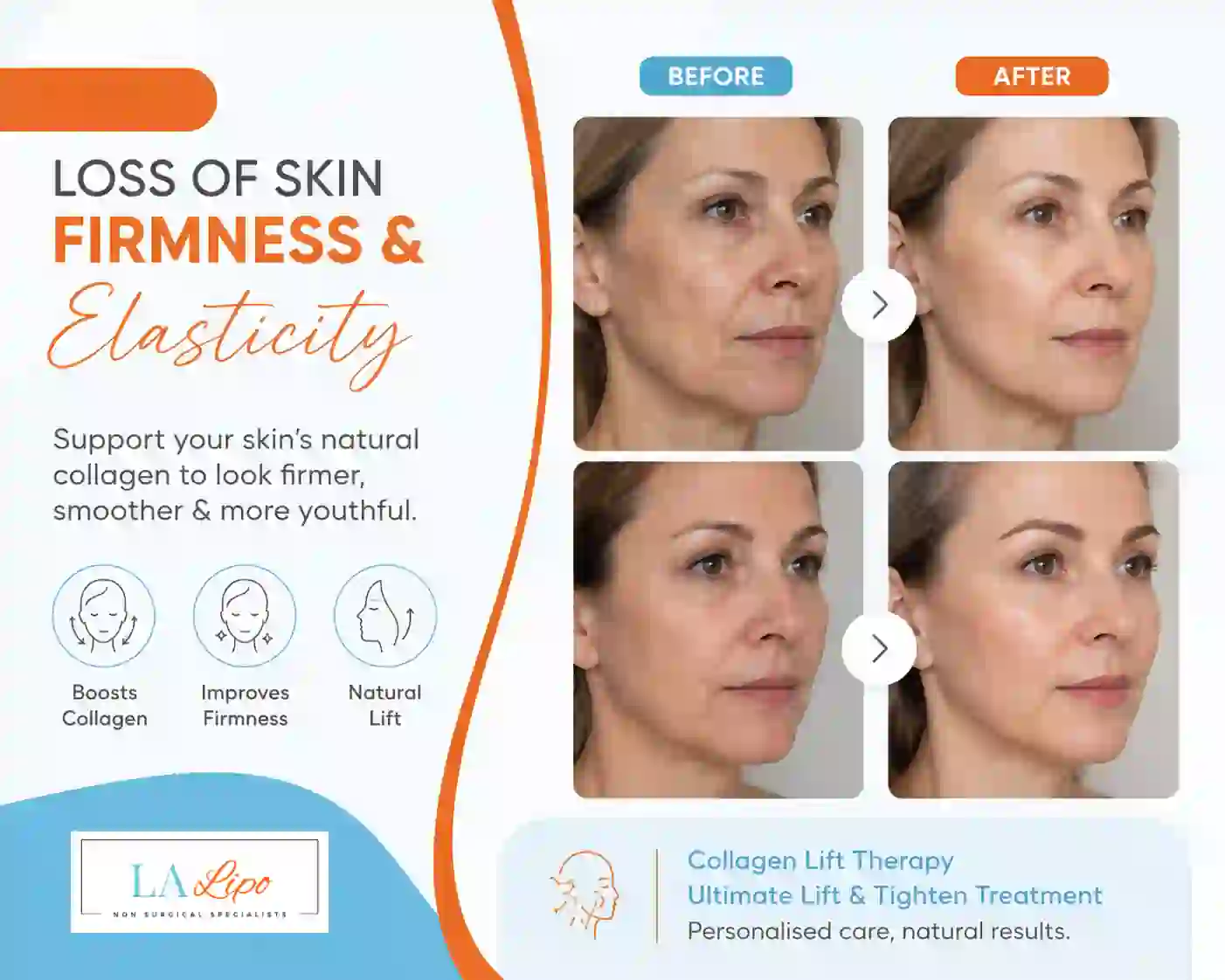 Sign #7: Loss of Skin Firmness and Elasticity Crawley