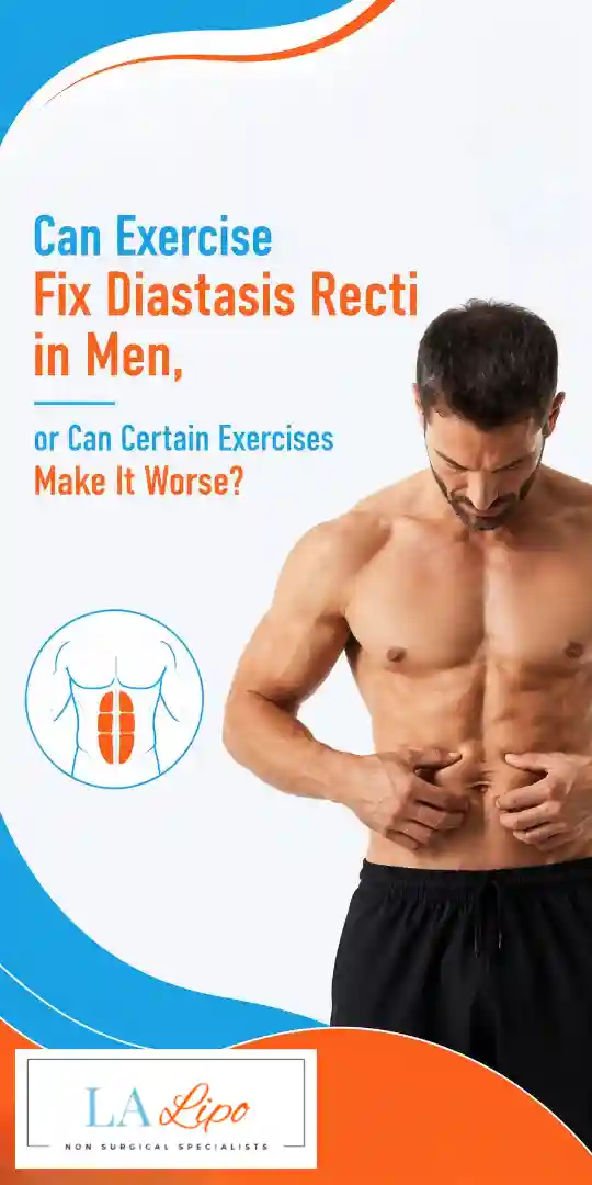 Can Exercise Fix Diastasis Recti in Men, or Can Certain Exercises Make It Worse Crawley?